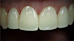 albany-smile-dentistry02